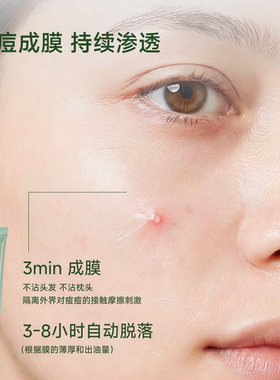 祛痘舒缓修护敏感肌适用