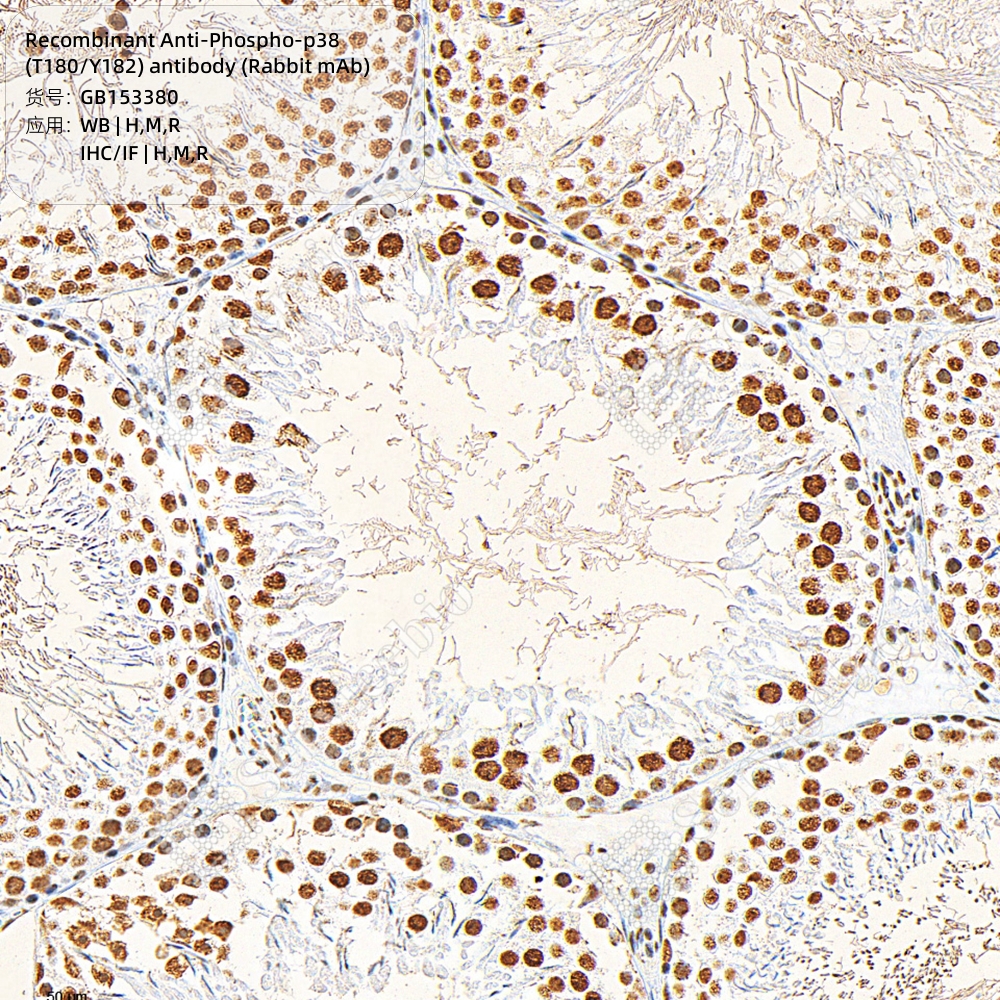 现货 Recombinant Anti-Phospho-p38 (T180/Y182) antibody (Rabbit mAb) GB153380 100ul 科研生物实验抗体 - 图2