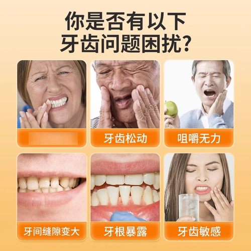 益口宁官方正品洁离剂固齿适用牙齿萎缩松动美白牙膏h - 图0