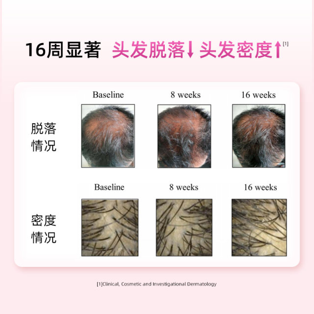Vegitalk Biotin Iron Hair Nutrition Capsules