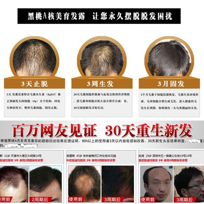 黑桃A核美育发液本草植物防脱生髪增发134号单擦男女脱发掉发白发,淘宝优惠券,粉丝福利购,淘宝优惠卷