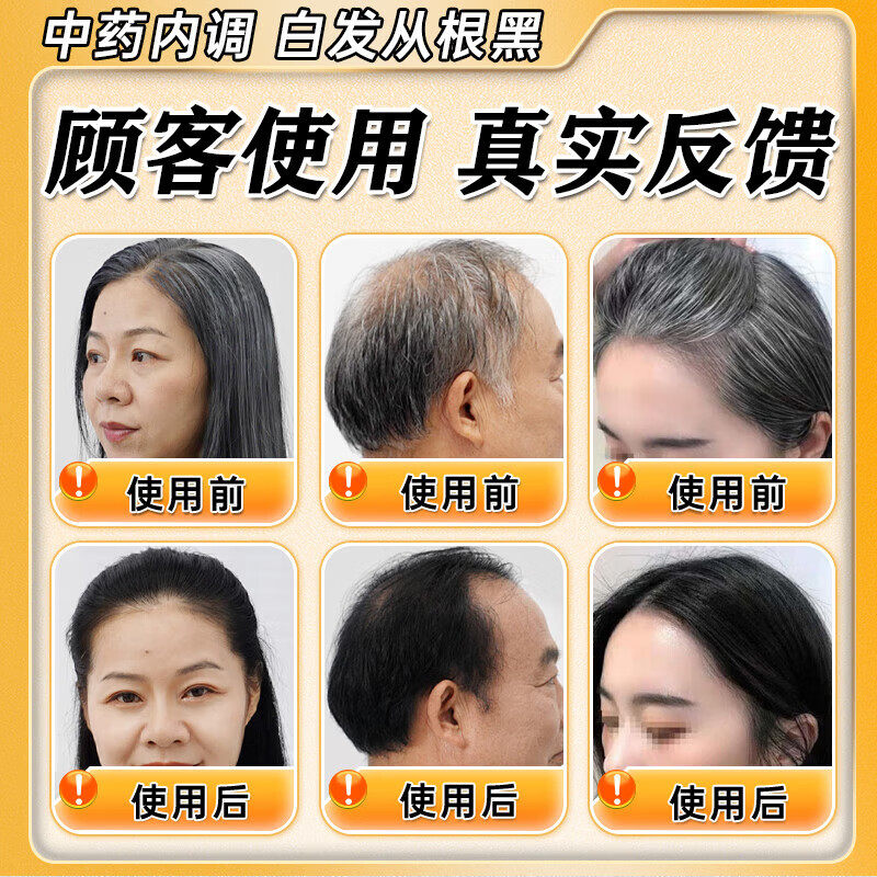 二至丸京北同非仁堂白发治发根转黑肾精亏虚气血不足严重白发脱发,淘宝优惠券,粉丝福利购,淘宝优惠卷