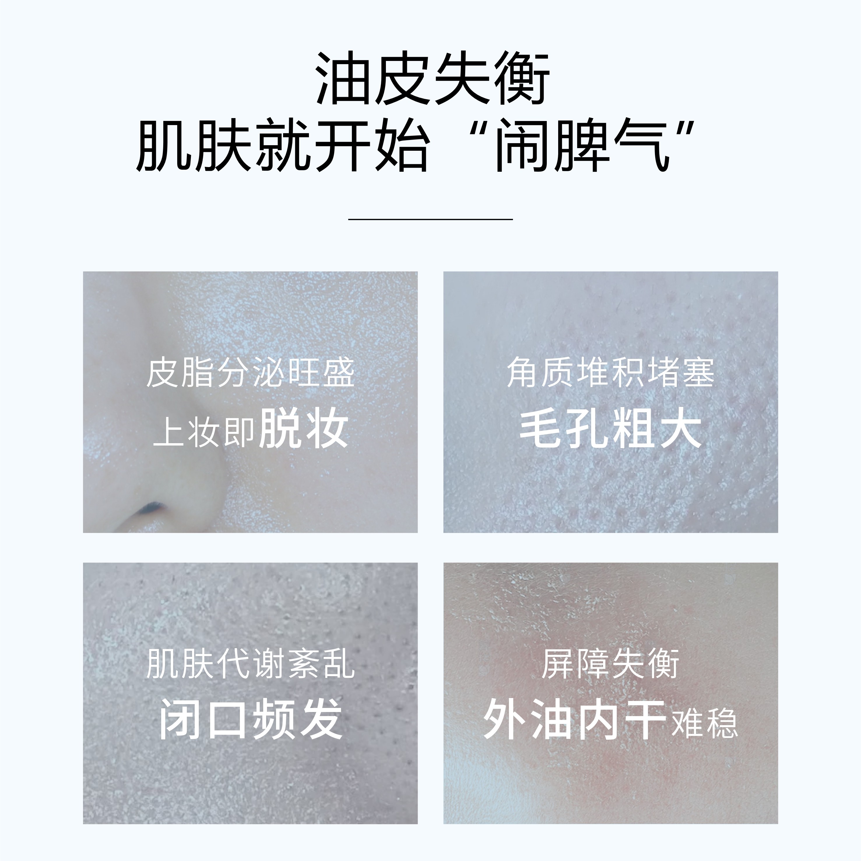 sqt油皮精华次抛 控油紧致收缩毛孔 油皮肌专研毛孔调理精华2ml*2