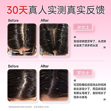 爆！WonderLab生物素防脱养发肤甲软糖60粒[90元优惠券]-寻折猪