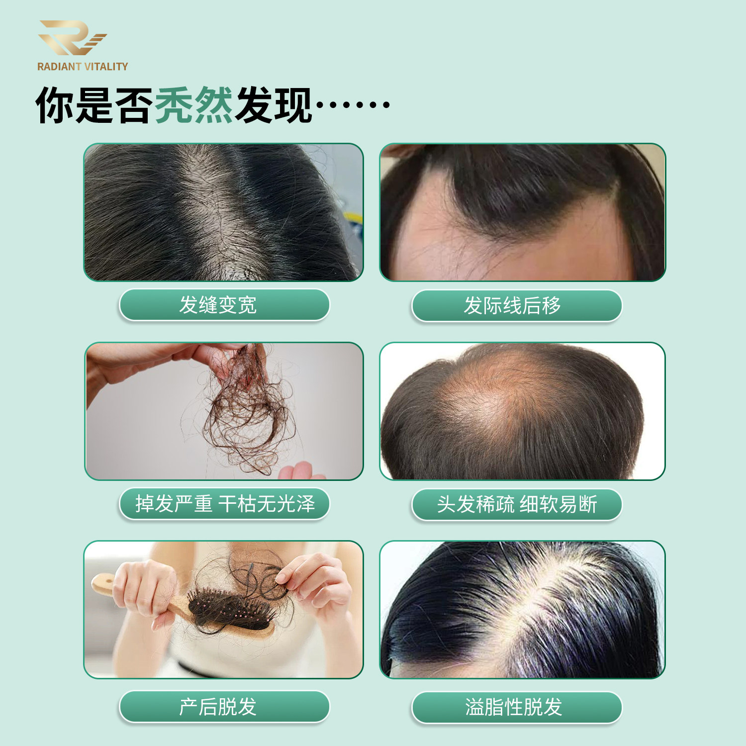 RADIANTVITALITY新西兰进口何首乌养发护发胶囊防生物素内服脱发,淘宝优惠券,粉丝福利购,淘宝优惠卷