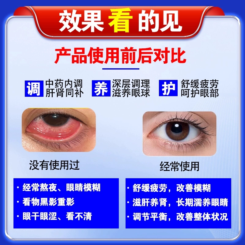 Mingmu Dihuang Pills 0.375g*200 pills/box