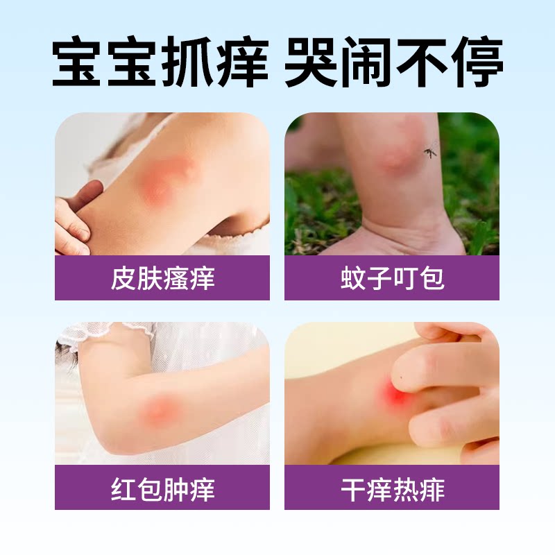 蓝帆医疗！止痒防蚊虫叮咬专用紫草膏