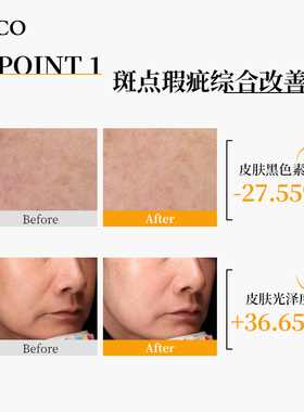 SZCO白玉微针面膜抗皱紧致