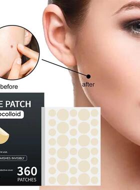 360PCS  Acne Pimple Patch Sticker Waterproof Acne atment Pim