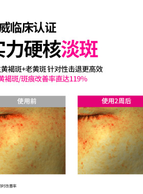韩国ISOI伊所爱臻白多效面霜补水保湿淡细纹嫩肤提亮肤色改善暗沉