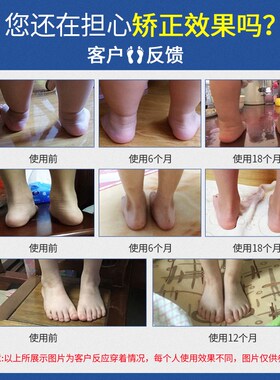 儿童足弓b矫正鞋垫足外翻矫正器横弓塌陷支撑脚垫扁平足内八字纠