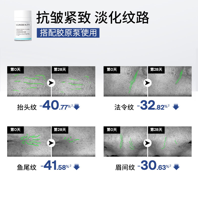 Ulike童颜超光炮牛奶光美容仪水光仪家用脸部光子嫩肤祛黄美白