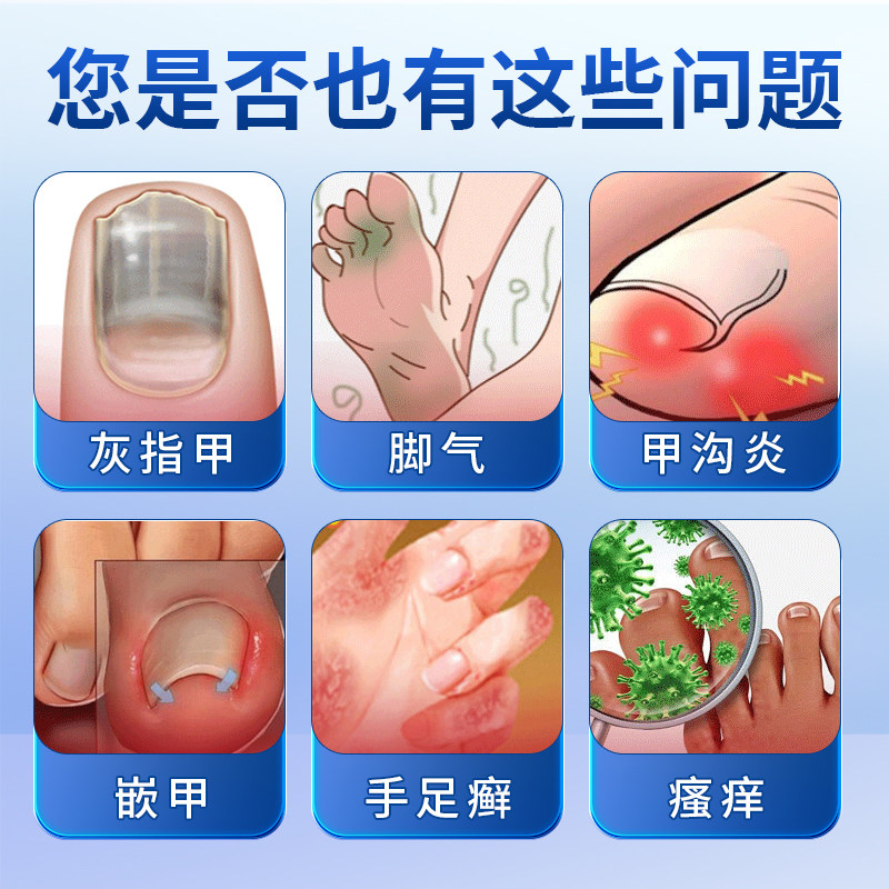 甲总管医用足部敷料甲宝玉凝胶灰指甲膏甲沟炎趾发黄变厚红肿痛痒,淘宝优惠券,粉丝福利购,淘宝优惠卷