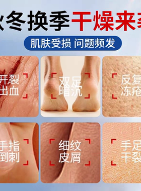 医用凡士林凡士林手足干裂膏