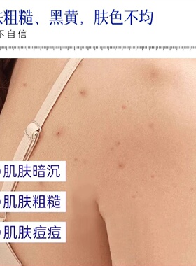 欧姿萃身体抛光水祛痘喷雾去前胸后背部痘痘果酸淡化痘印保湿补水