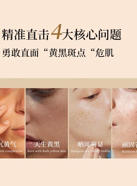 【官方正品】WOBECHON美白淡斑面膜美白提亮皮肤淡化脸部黑黄暗沉