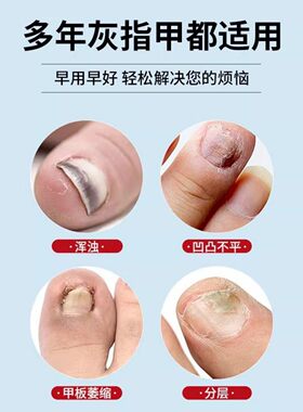 德国正品小蓝笔护甲提亮精华笔