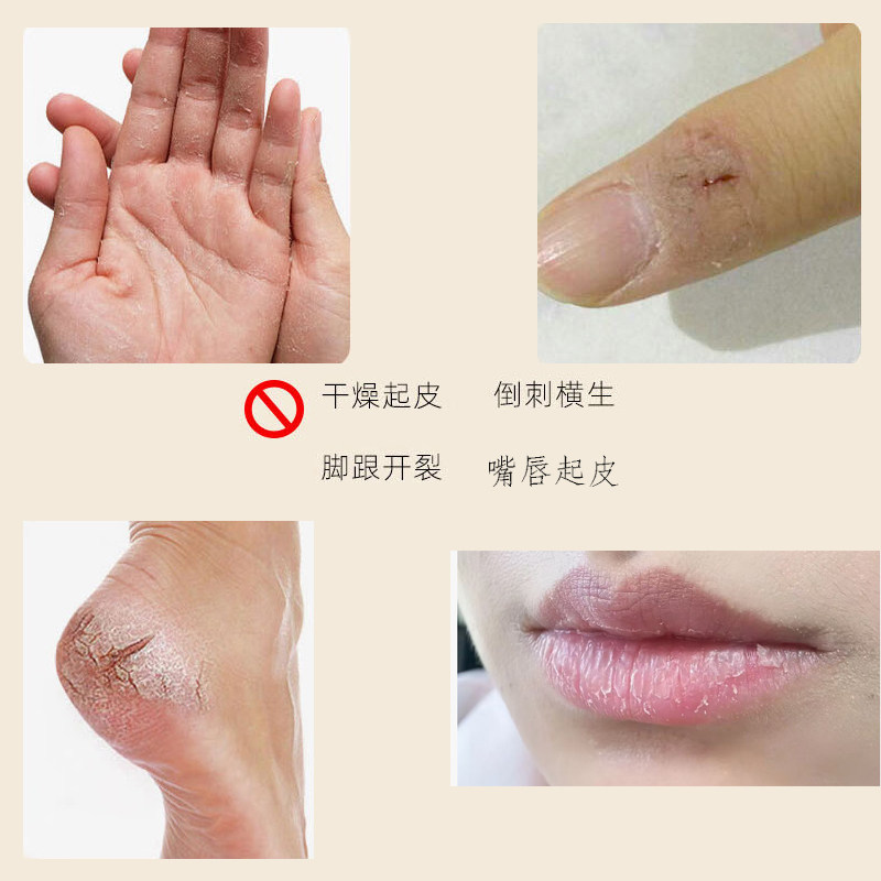 皴裂膏脚后跟干裂干燥修复霜龟裂防脚底开裂滋润保湿护手霜皲裂膏,淘宝优惠券,粉丝福利购,淘宝优惠卷