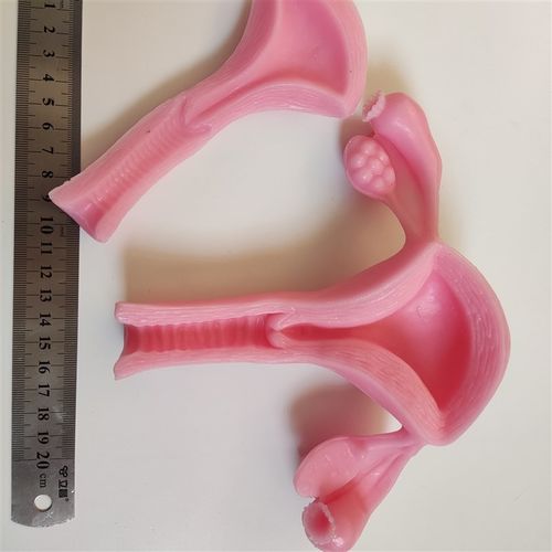 妇科宫腔镜外科腹腔镜剪切缝合剥离训练练习硅胶3D仿生模块模型 - 图2