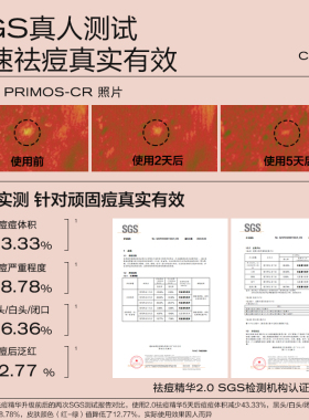 【限时扶持价】大水滴 精准祛痘点涂精华2.0（10ml+棉签20*1）