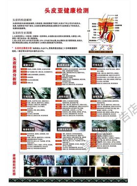 头皮检查对照图高清自粘海报养发图片定制理发店广告皮肤的结构图