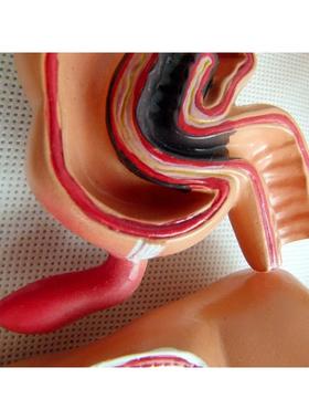 人体结病变模型肛肠模肠科化内科消大肠型医HCY学人体解剖学