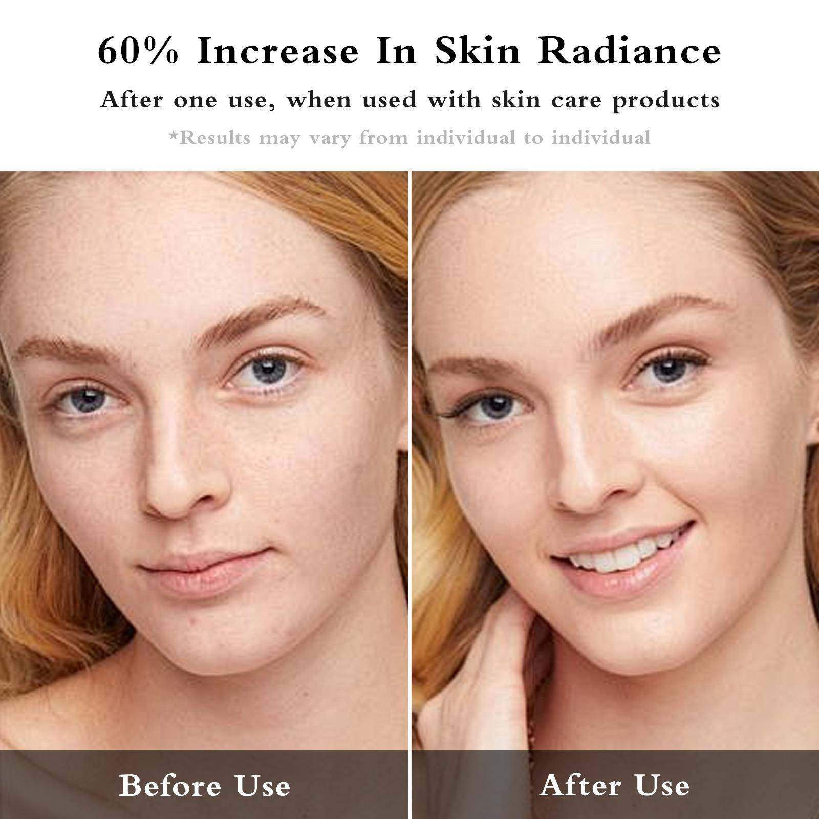 水光EMS振动红蓝彩光美容仪导入仪眼部脸部按摩仪家用美眼仪,淘宝优惠券,粉丝福利购,淘宝优惠卷