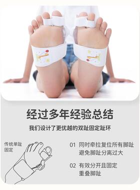 儿童拇指外翻矫正器大脚拇趾外翻矫正器重叠趾脚趾分趾器分离器