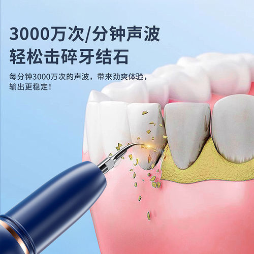 进口超声波家用洁牙器洁牙除牙结石清除牙齿污垢安全护齿神器 - 图1