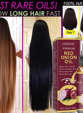 Ginger Hair Growth Essential Oil Fast Grow Anti Hair Loss Pr