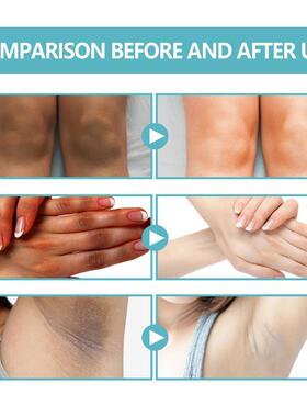 Underarm Whitening Creams For Dark Skin Lightening Body Crot