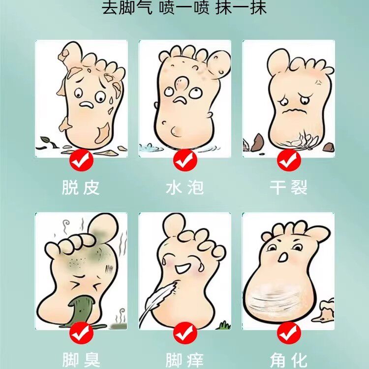 云南本草脚气除脱皮杀菌喷雾去烂脚丫止痒膏臭脚出汗脚痒水泡喷剂