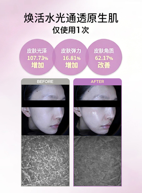 AIPPO精华安瓶胶原美白去角质