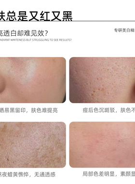薇俪兰烟酰胺VC氨甲环酸精华