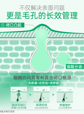 【韩国版】ilso一苏控油闭口水舒缓祛痘水修护泛红保湿去粉刺祛痘