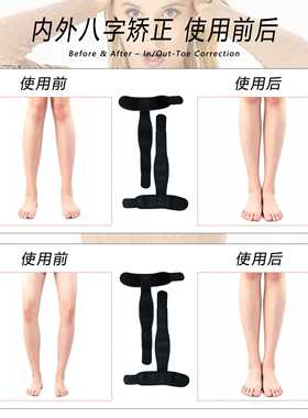 儿童内八字矫正器绑腿带腿型纠正腿带学生外八字内翻外翻矫形带