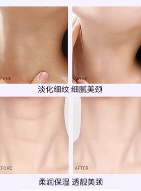 【颈纹小熨斗】多肽颈膜去颈纹脖子嫩白细纹提拉紧致脖贴颈部护理