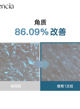 Arencia神香草年糕洁面膏洗面奶女清洁毛孔黑头泥膜油皮护肤品