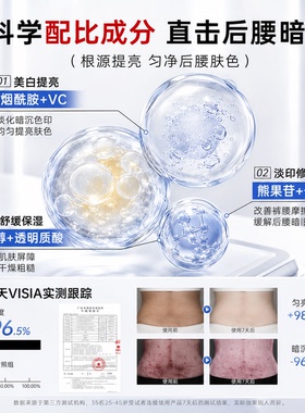医续美后腰黑色素沉淀去除膏摩擦沉淀去黑皮肤烟酰胺官方正品EF