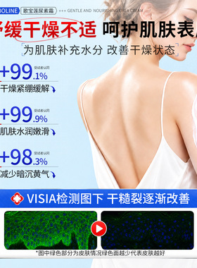 歌宝莲20%尿素护足霜保湿防裂