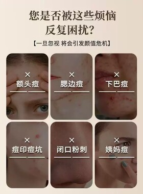 七子白椰油香脂皂深层清洁控油去黑头除螨祛痘香皂正品养肤草本