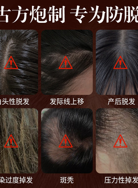 南京同仁堂乐家老铺汉达防脱育发