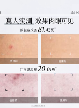 谷雨男士补水控油淡痘印润肤乳