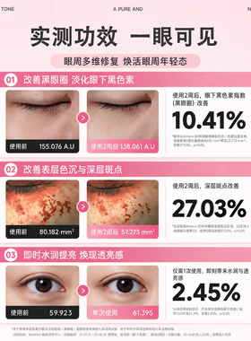韩国正品begins眼膜贴