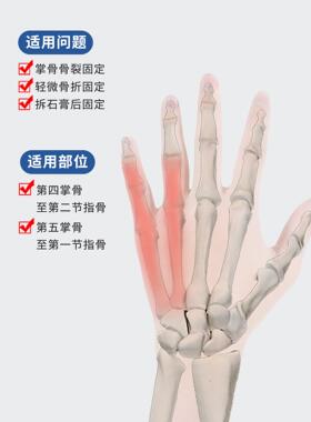 顺丰空运第五掌骨骨折固定器手指指套手掌小拇指支具手腕固定支具