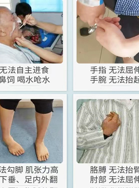 多功能吞咽四肢复健仪免费试用