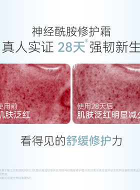 神经酰胺修护霜敏感肌舒缓泛红保湿补水滋润面霜