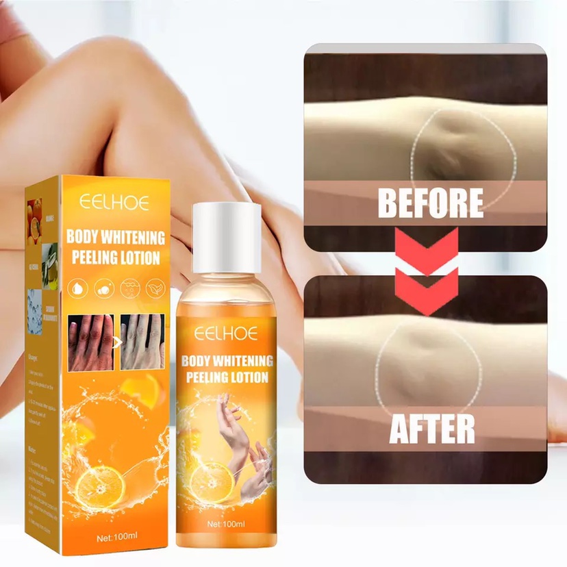 Whitening Peel Peeling Gel Peeling Mask Fnger Knee Brighten - 图3