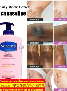 south africa vaseline body lotion even tone skin vitamin B3