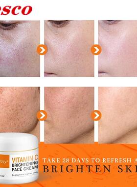 Face Cream Vitamin C Remove Dark Spots Whitening Skin Care